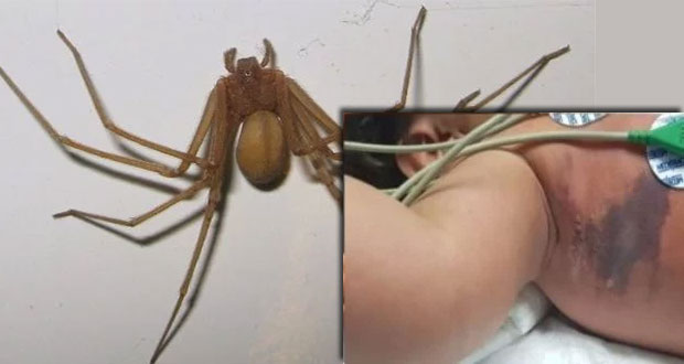 Tras más de 1 mes, muere bebé mordido por araña violinista en Nayarit